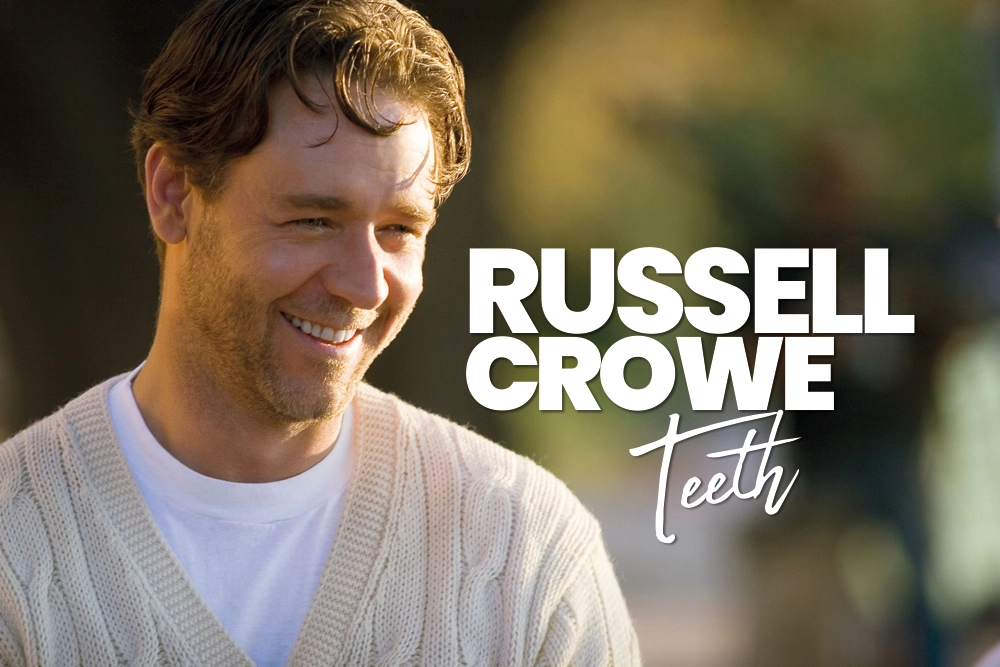 Russell Crowe Teeth