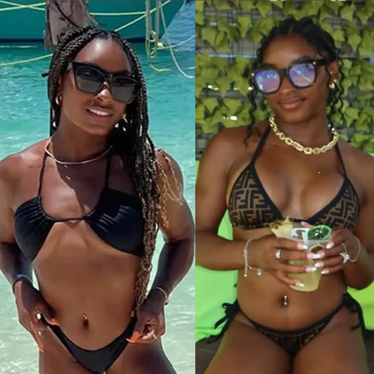 Simone Biles Surgery Rumors