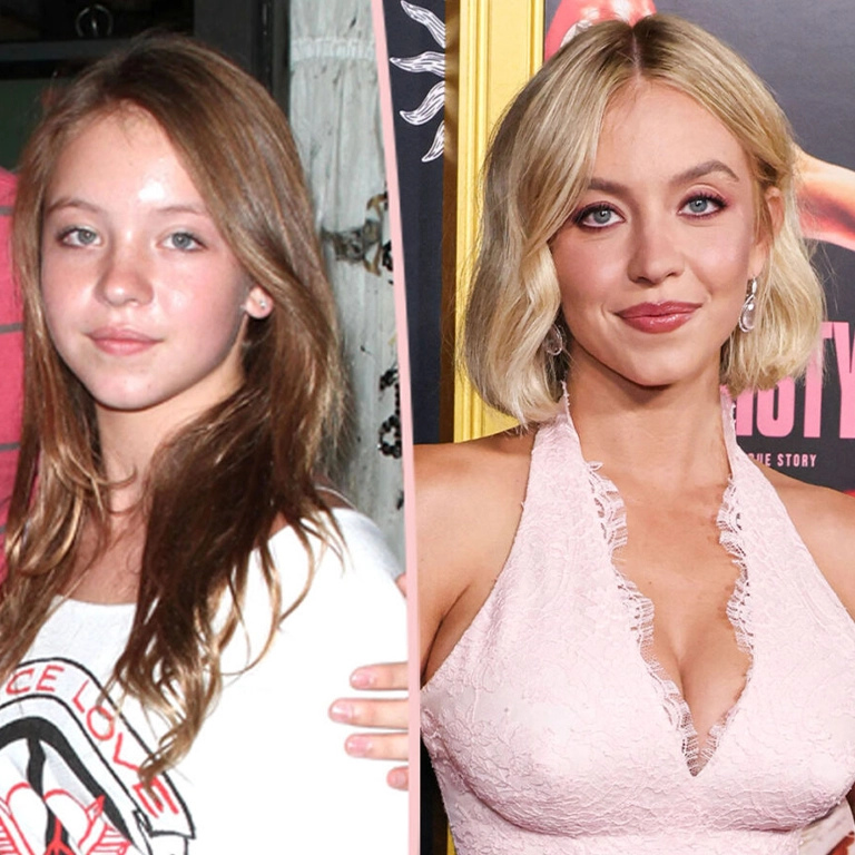 Sydney Sweeney Nose Job