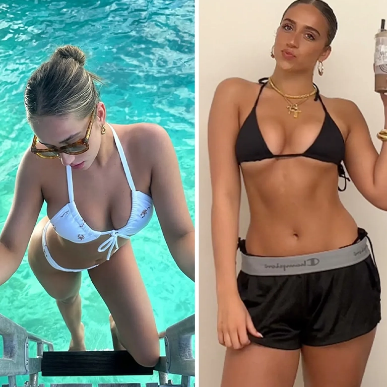 Tate McRae Breast Augmentation