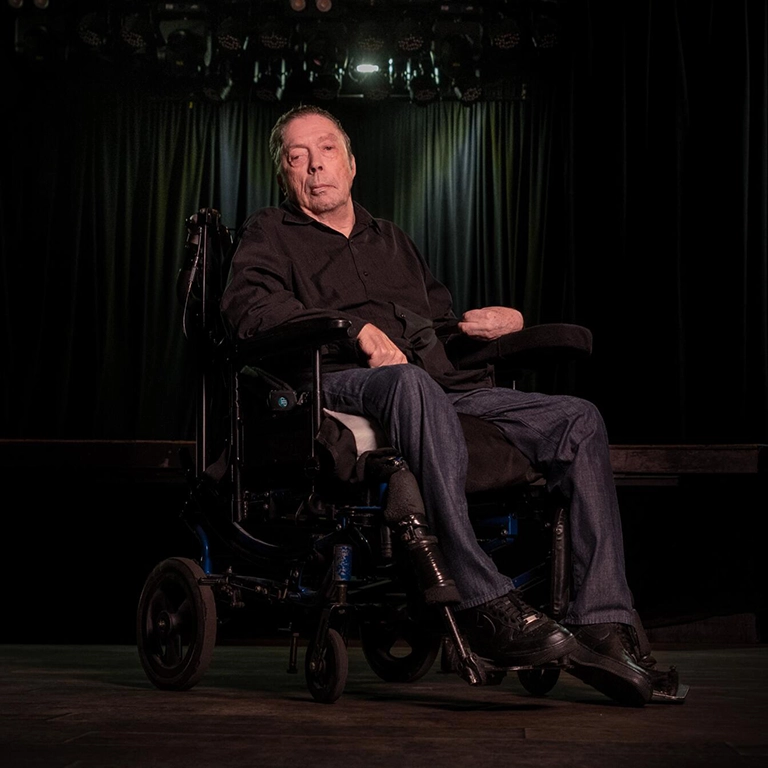 Tim Curry Botox Rumors