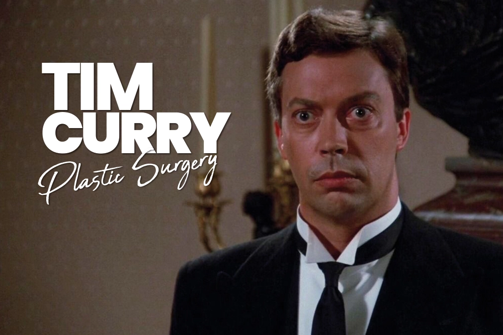 Tim Curry Plastic Surgery