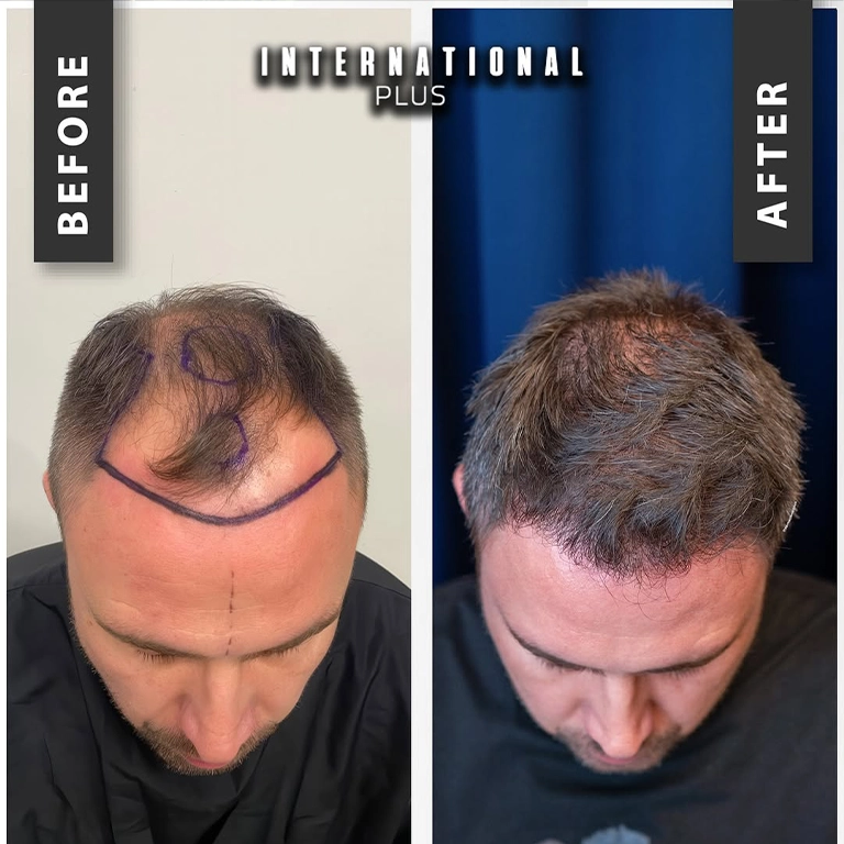 Accommodation and Transfer Costs