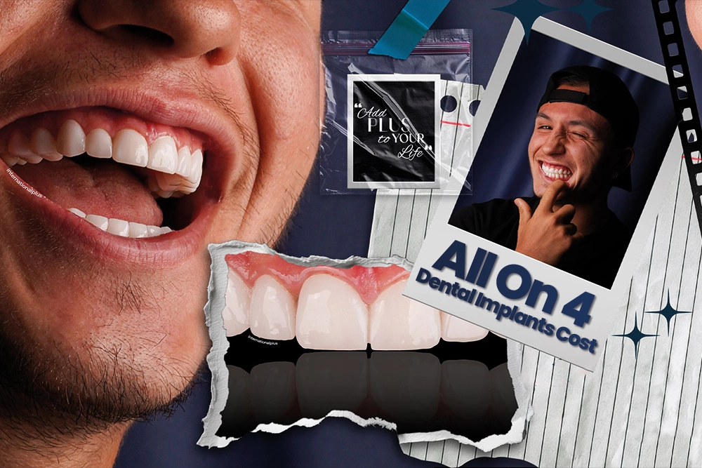 All On 4 Dental Implants Cost