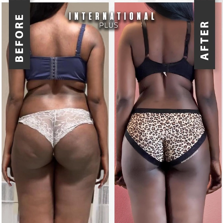 BBL In Turkey Reviews 2025