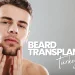 Beard Transplant Turkey