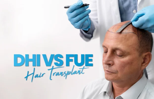 DHI vs FUE Hair Transplant