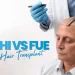DHI vs FUE Hair Transplant