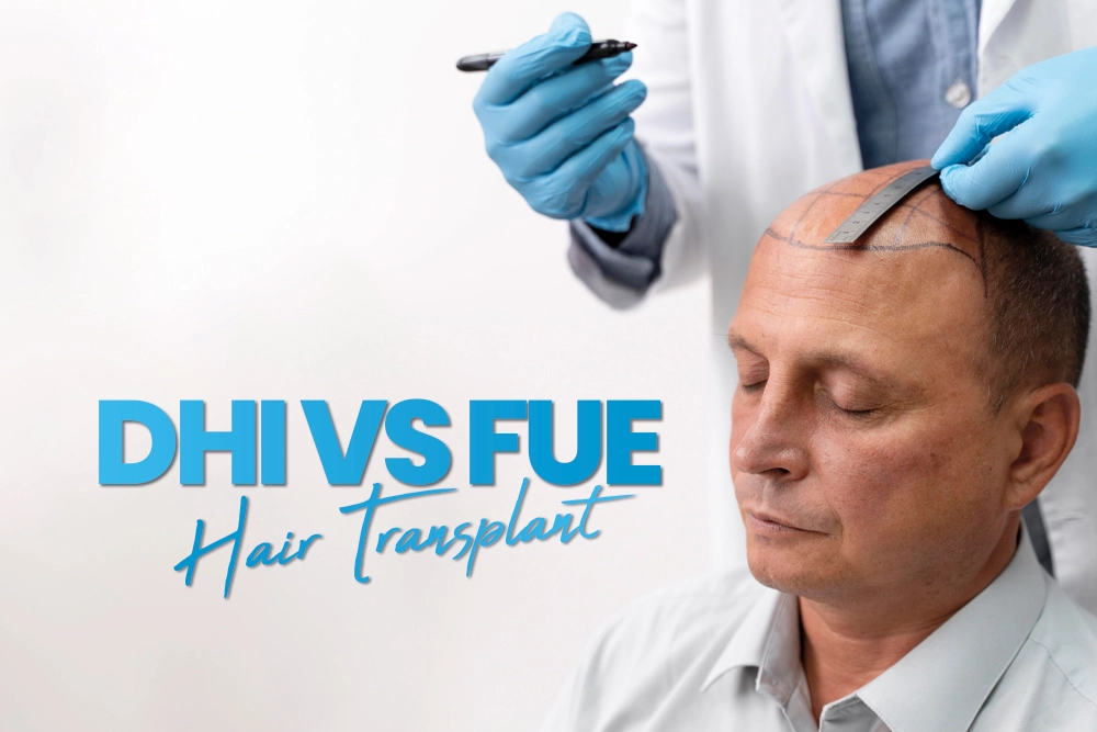 DHI vs FUE Hair Transplant