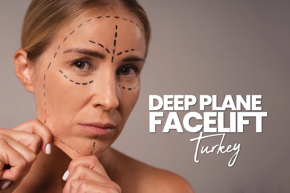 Deep Plane Facelift Turkey