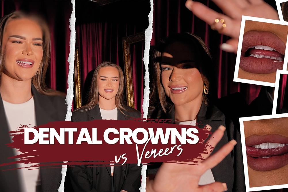 Dental Crowns vs Veneers