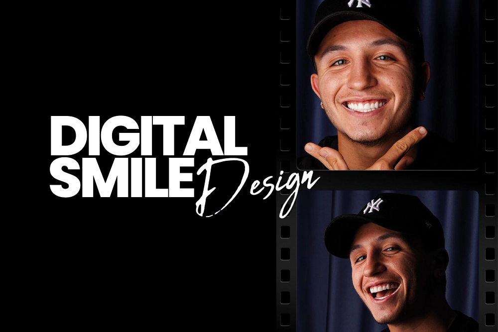 Digital Smile Design