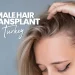 Female Hair Transplant Turkey