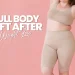 Full Body Lift After Weight Loss