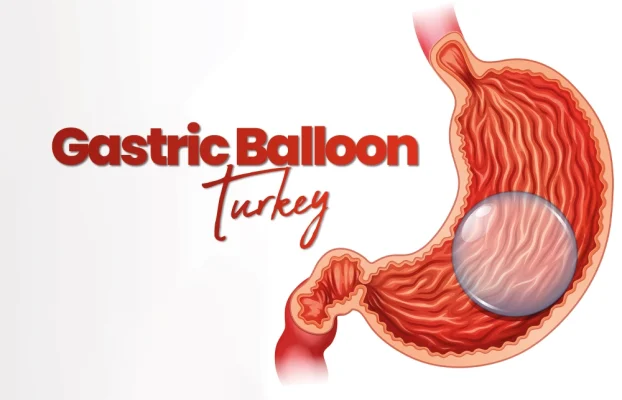 Gastric Balloon Turkey