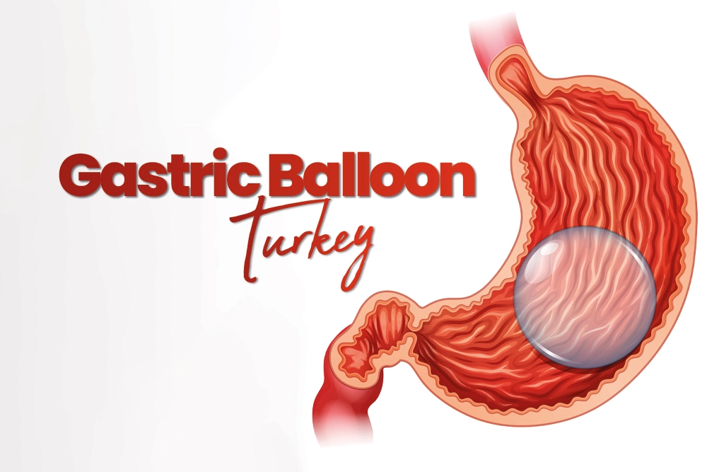 Gastric Balloon Turkey