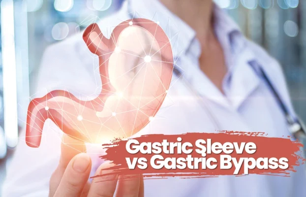Gastric Sleeve vs Gastric Bypass
