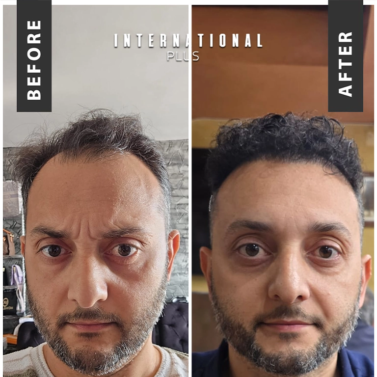 Healing Process Explained