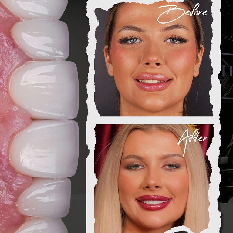 Hotel and VIP Transfer Services