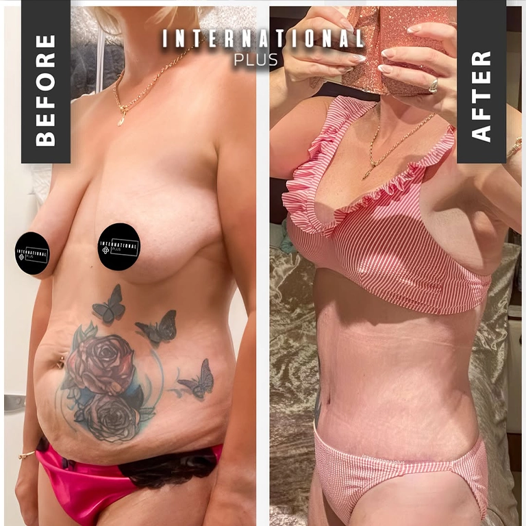 JCI Accredited Hospitals Turkey