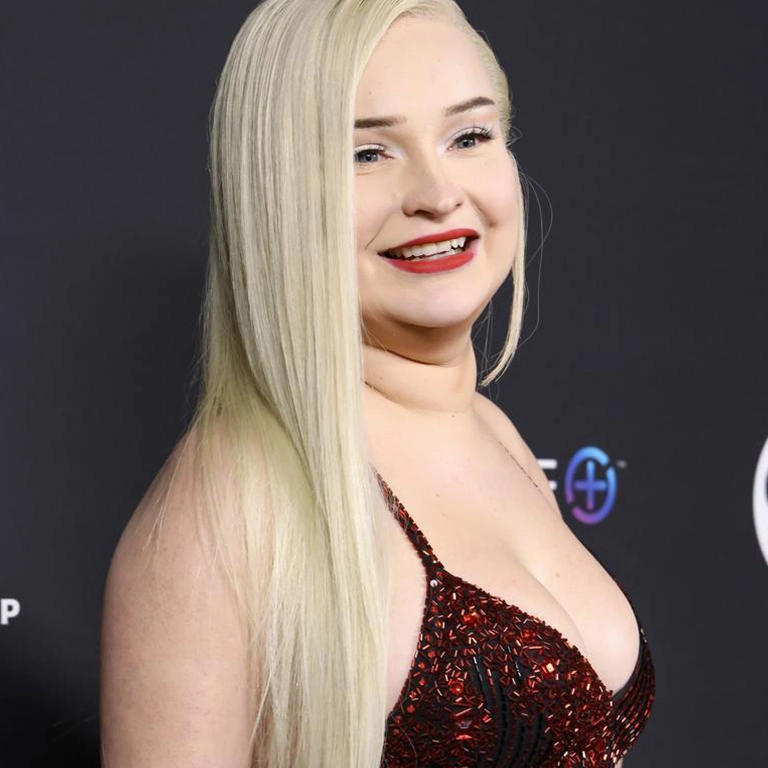 Kim Petras Before and After