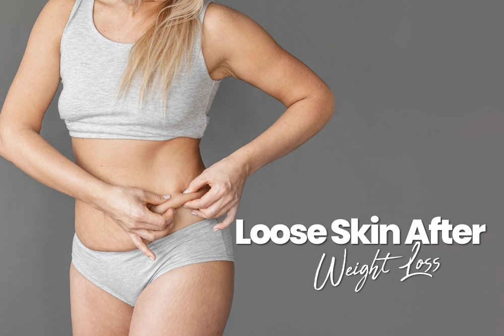 Loose Skin After Weight Loss