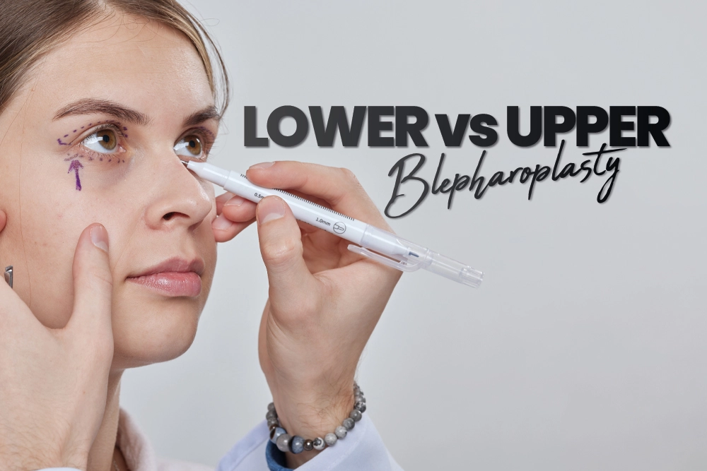Lower vs Upper Blepharoplasty