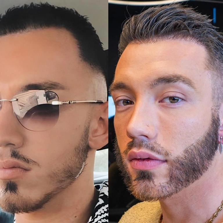 Patchy Beard Solution