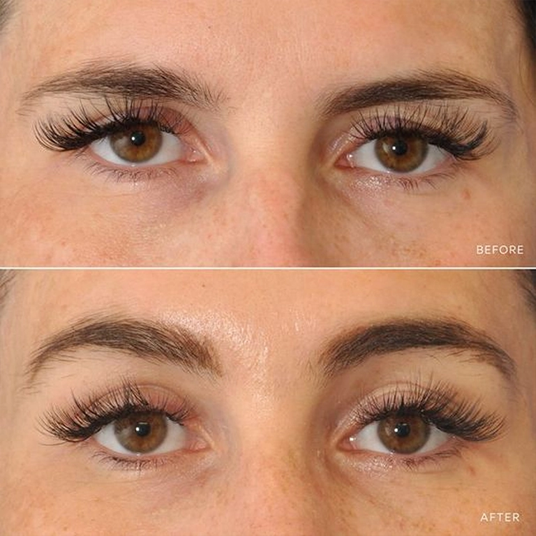 Permanent Eyebrow Solution