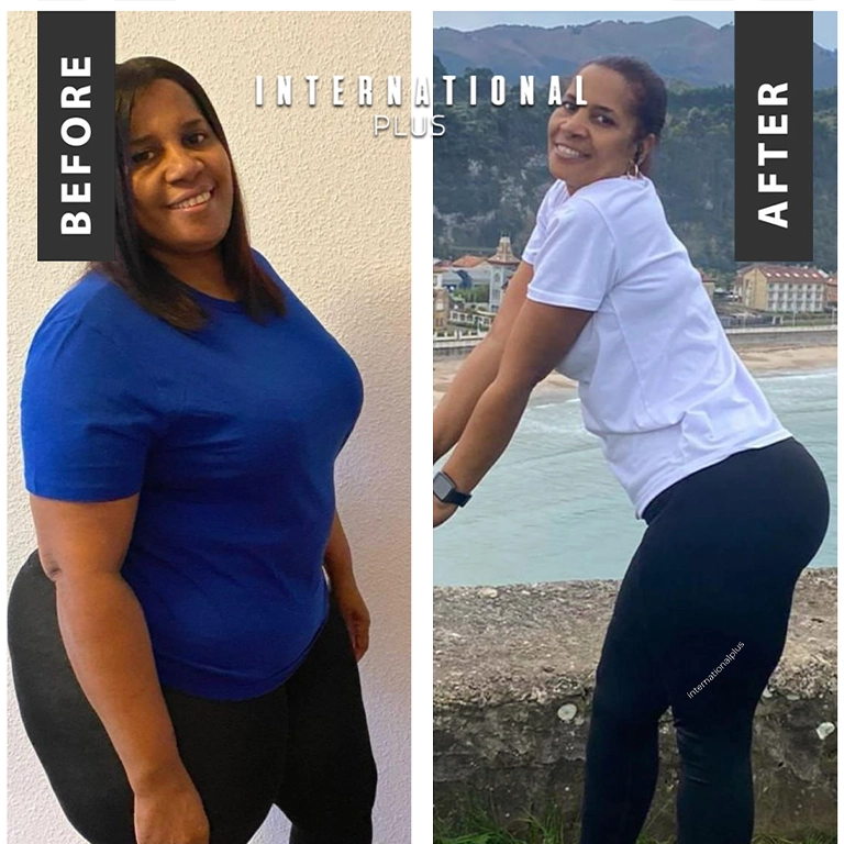 Protein Intake and Hair