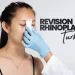 Revision Rhinoplasty Turkey