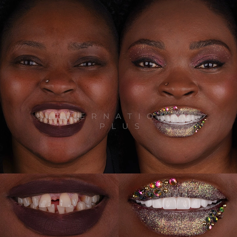 Same Day Dentistry Turkey