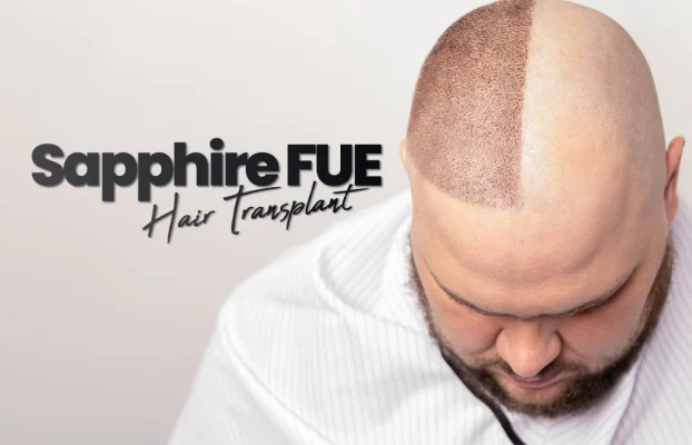 Sapphire FUE Hair Transplant
