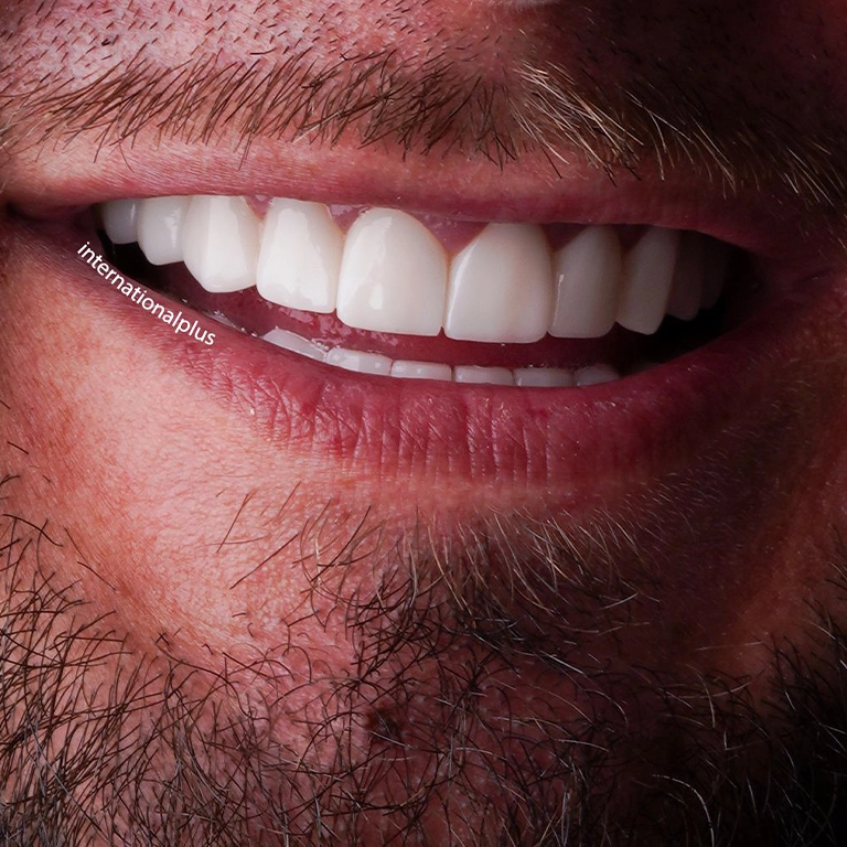 Saving Money On Dental Care