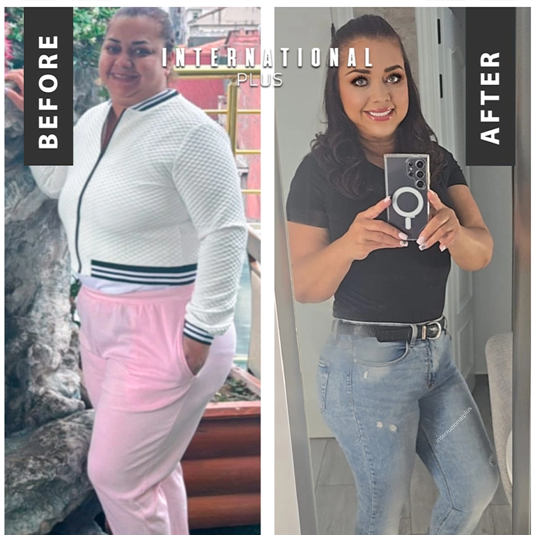 Swallowable Gastric Balloon