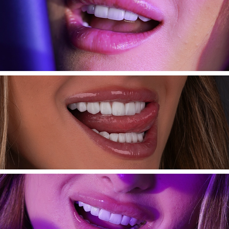 Turkey Teeth Gone Wrong Fixed