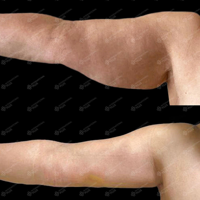 When To Get Skin Surgery