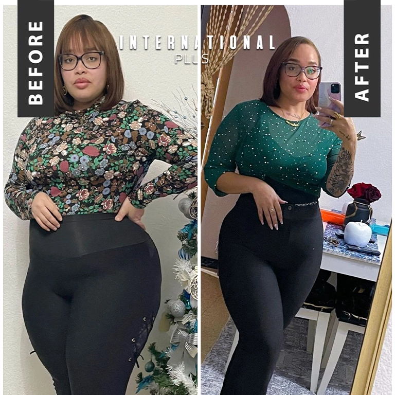 Why Hair Falls Out After Surgery