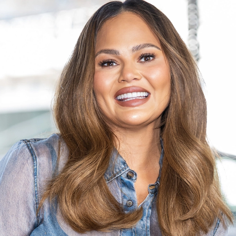 Celebrity Veneers Cost 2026