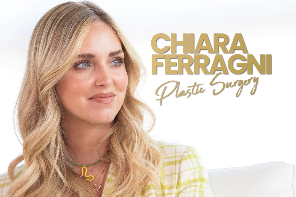 Chiara Ferragni Plastic Surgery