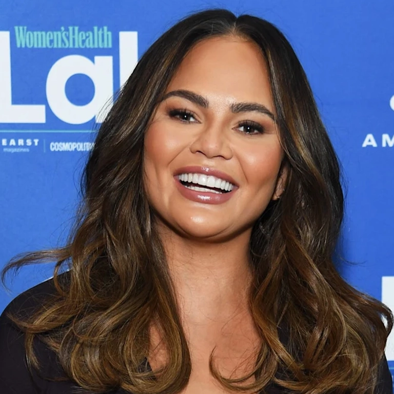 Chrissy Teigen Teeth Before and After