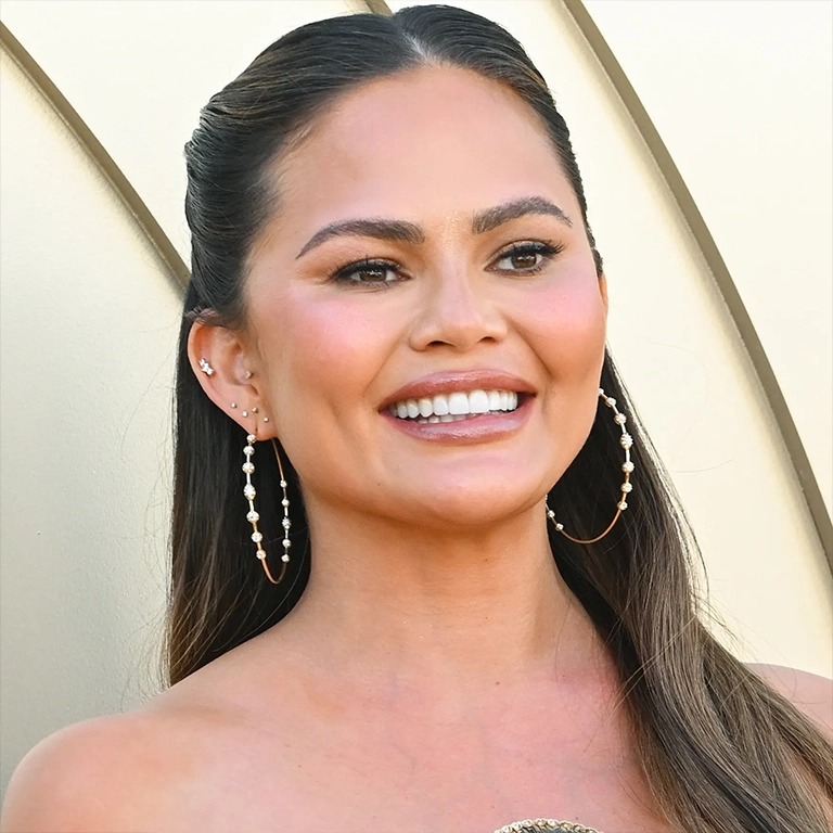 Chrissy Teigen Teeth Grinding Treatment (Bruxism)