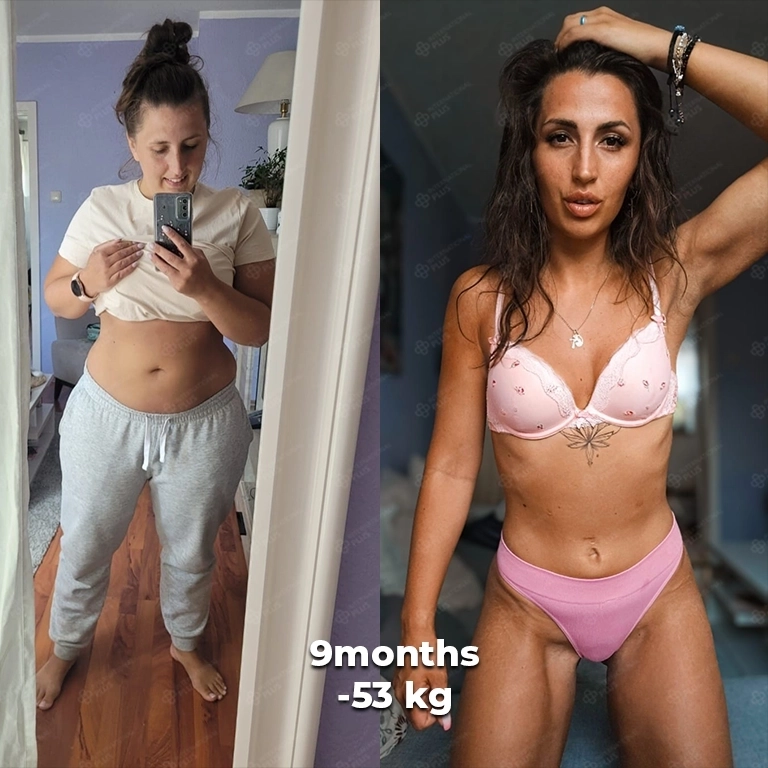 Hidden Fees In Bariatric Surgery