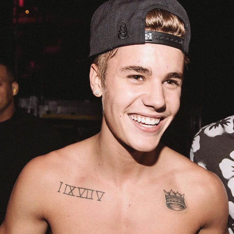 Justin Bieber Teeth Before and After