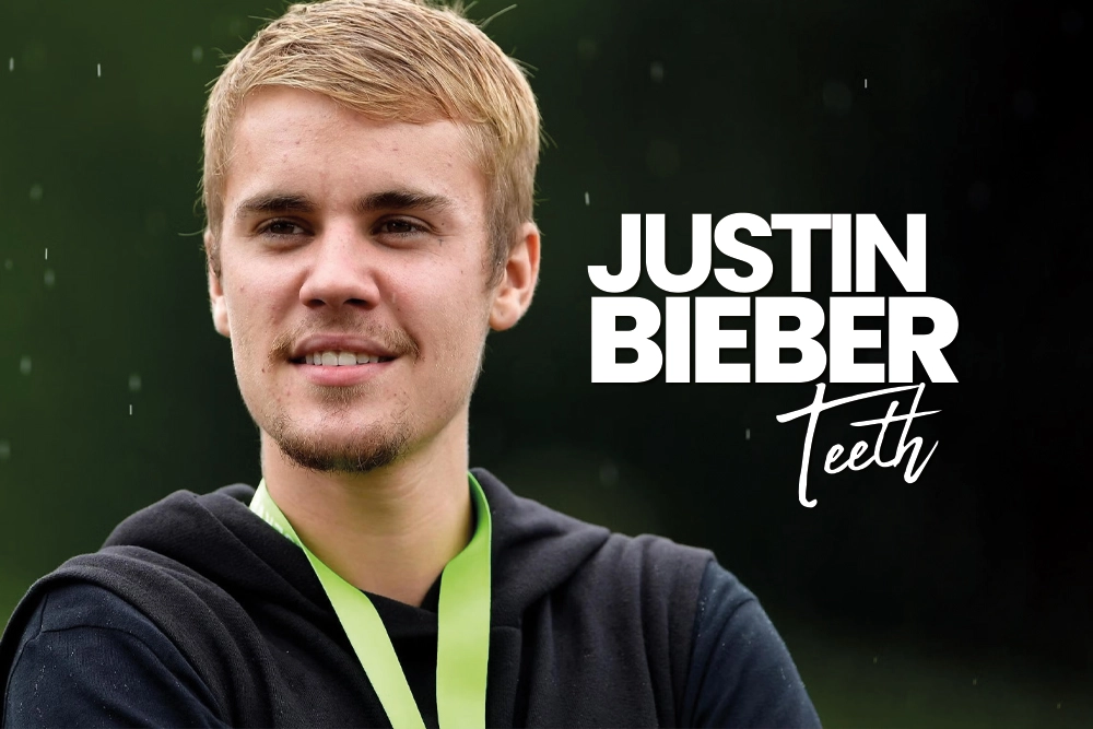 Justin Bieber Teeth
