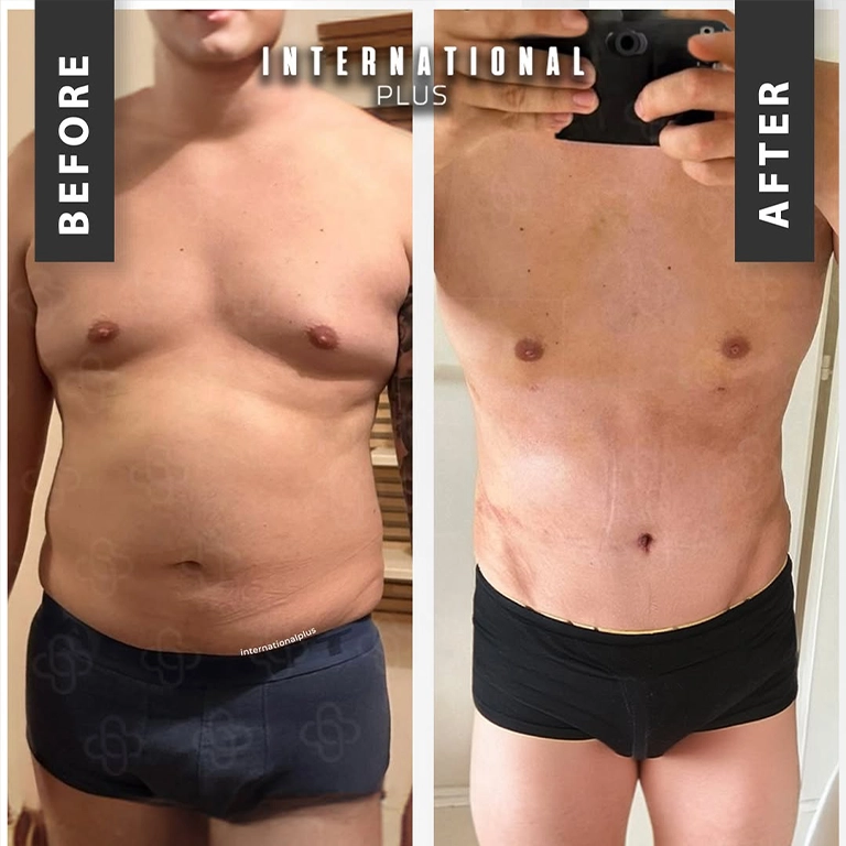 Recovery Tips For Male Patients