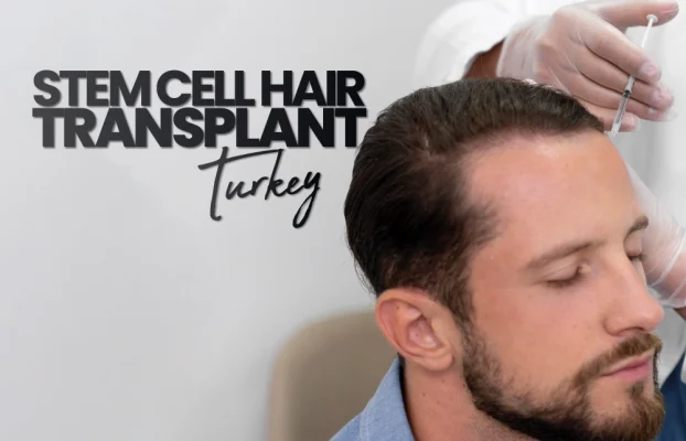 Stem Cell Hair Transplant Turkey