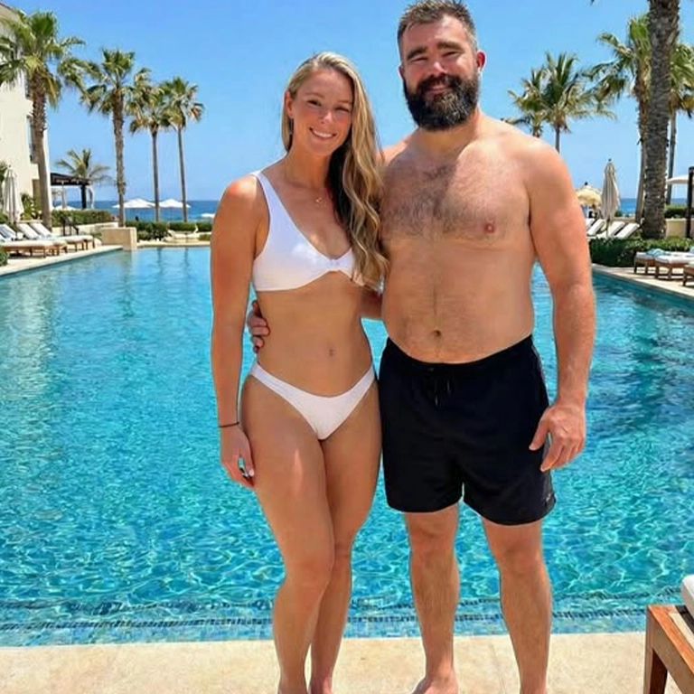 1. Kylie Kelce Plastic Surgery