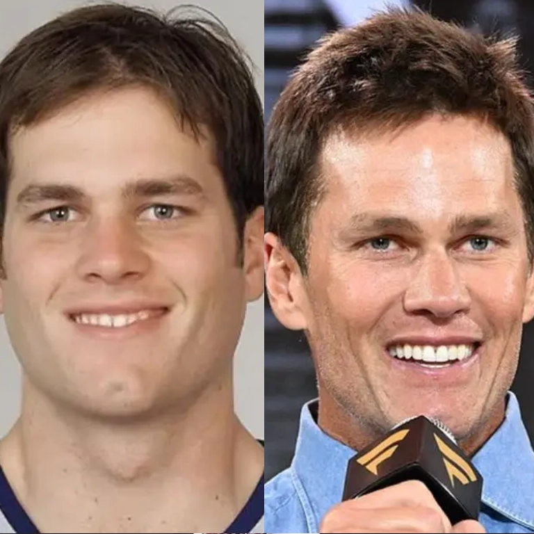 Analyzing the 2026 Ageless Face