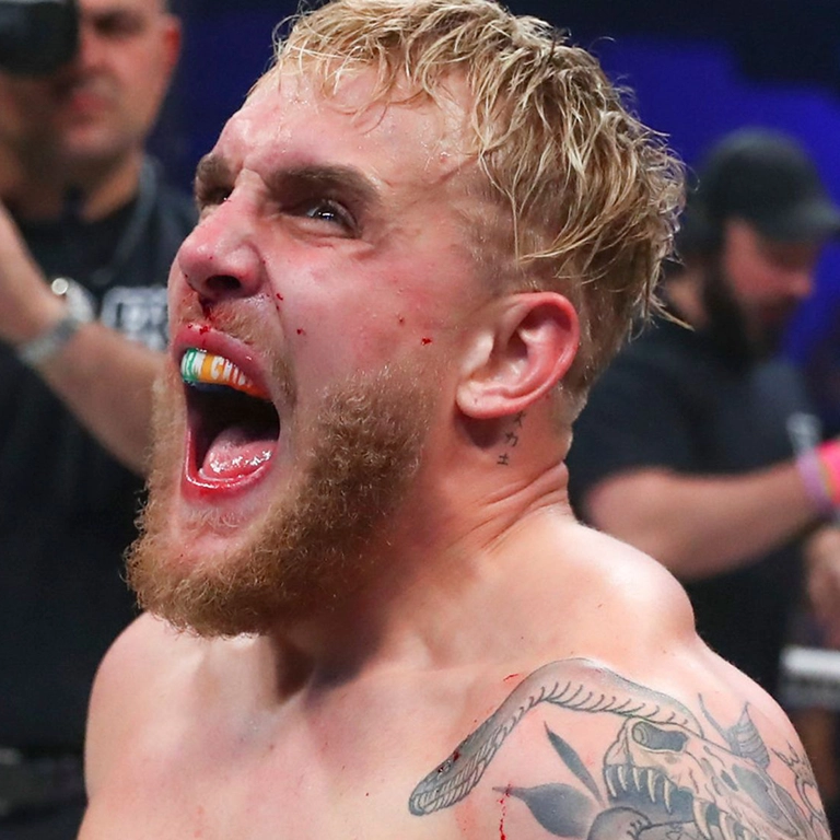 Jake Paul Teeth Whitening Secrets